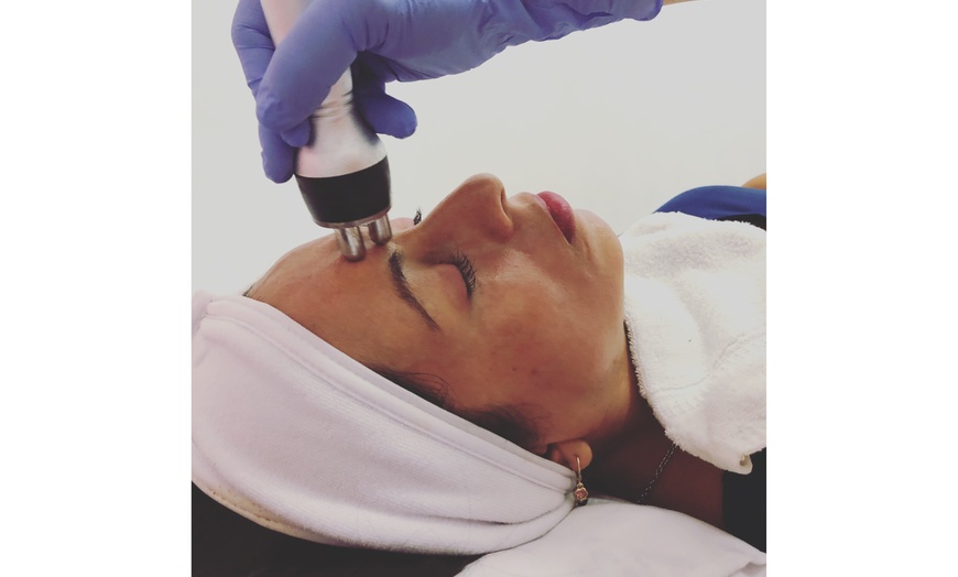 Image 1: 45-minute Radio Frequency Skin Tightening Treatment Package