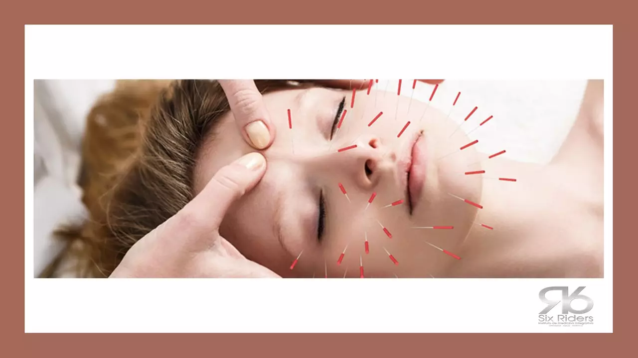 Up to 55% Off on Traditional Chinese Medicine at DRIVEN WELLNESS - Primary Image