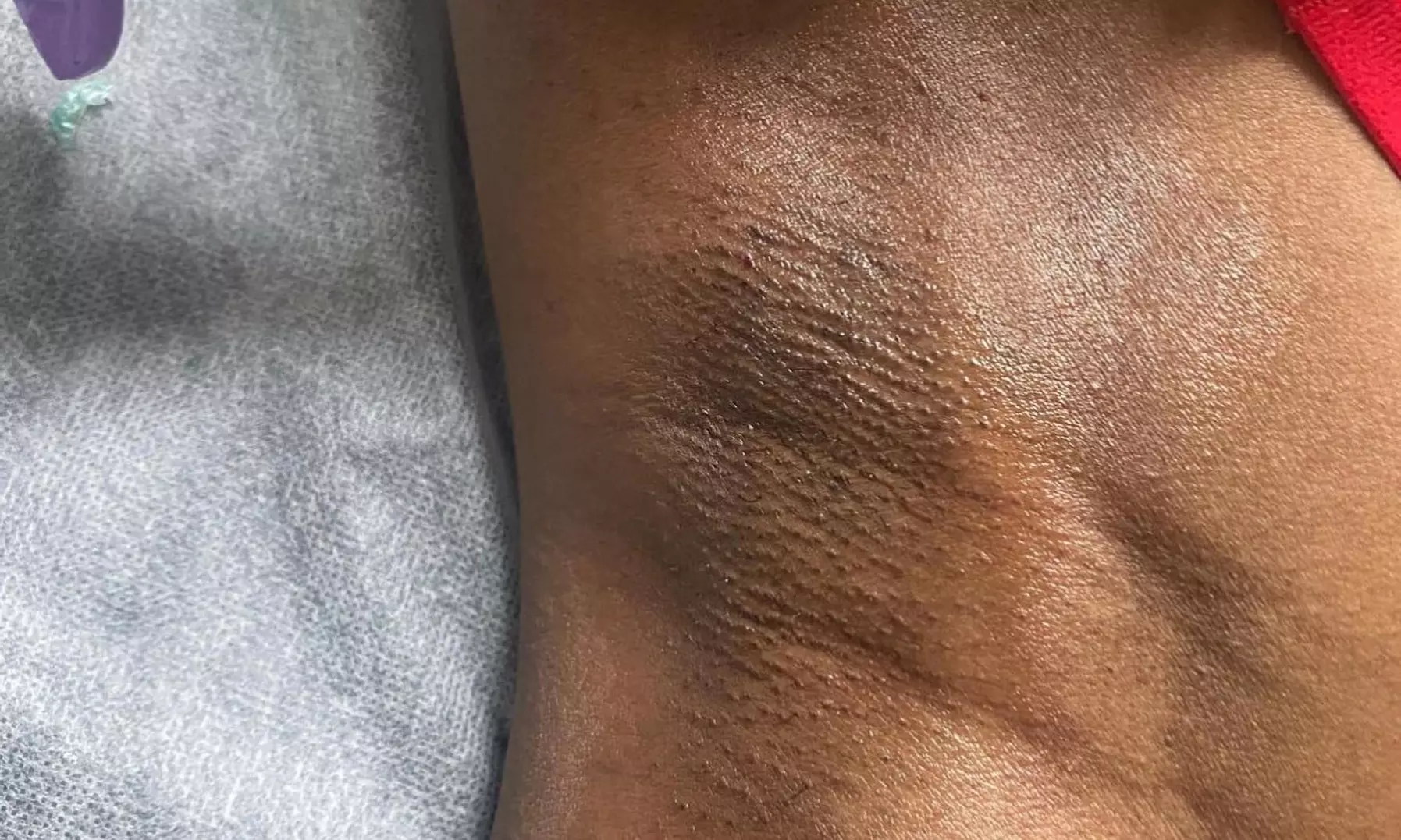 Up to 10% Off on Waxing at Dfewaxx - Second Medium