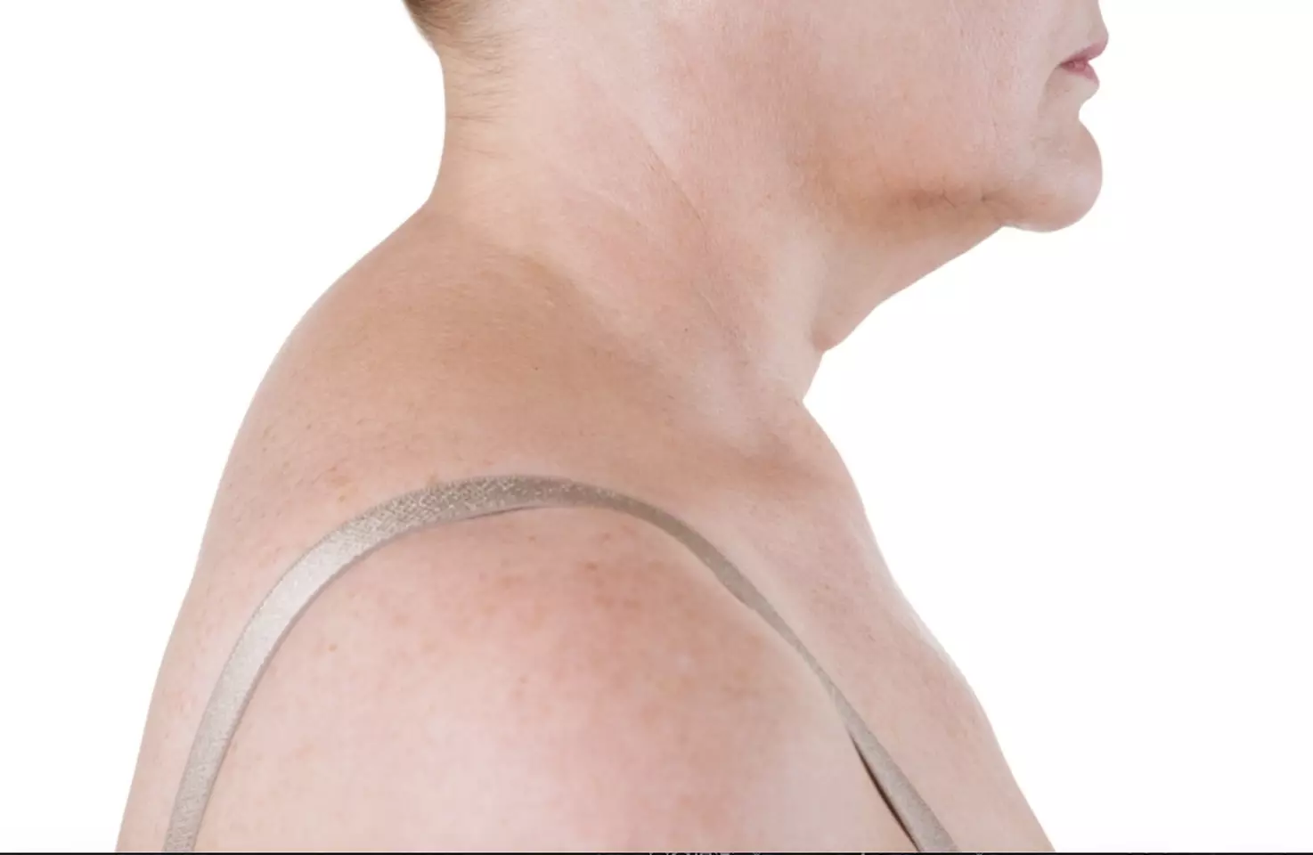 Up to 55% Off on Facial - Anti-Ageing at United Kingdom