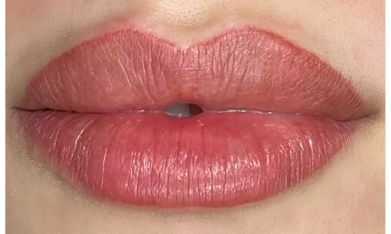 Experience B.A.R. NYC's lip enhancement with options like permanent blush for vibrant lips up to 30% off - Second Medium