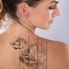 Image 3: 1 or 2 Sessions of Laser Tattoo Removal on Area Up to 5cm and More