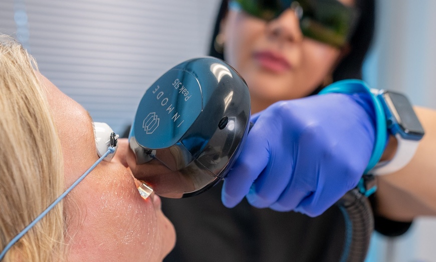Image 8: Get Radiant Skin with 1, 2, or 3 IPL Sessions - 10 Minutes Per Session
