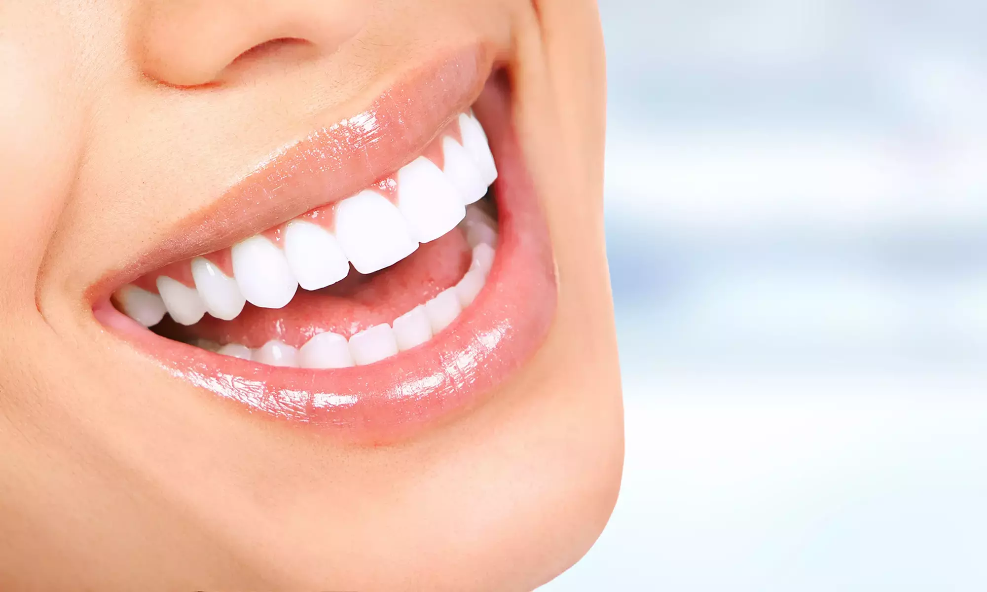 Achieve a Brighter Smile at The Laser Lab and Save Up to 79% Off - Primary Image