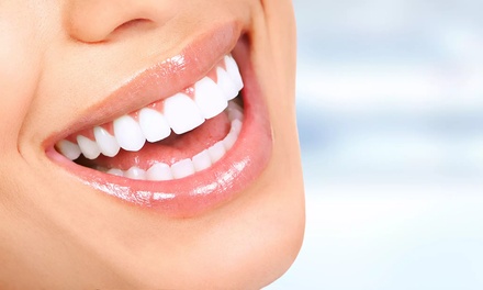 One Express Teeth Whitening Treatment - The Laser Lab