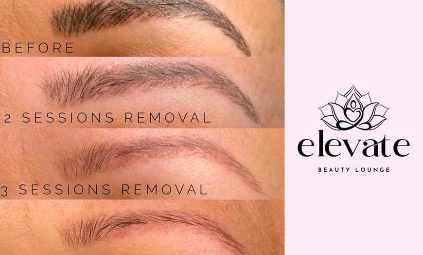 Image 2: Up to 40% Off on Tattoo Removal at Elevate Beauty Lounge