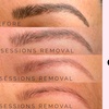 Image 2: Up to 46% Off on Tattoo Removal at Elevate Beauty Lounge