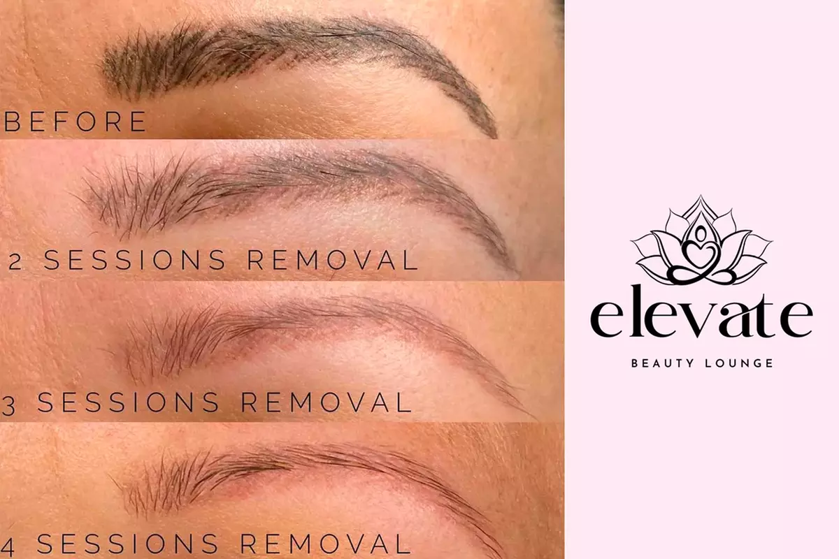 Up to 40% Off on Tattoo Removal at Elevate Beauty Lounge