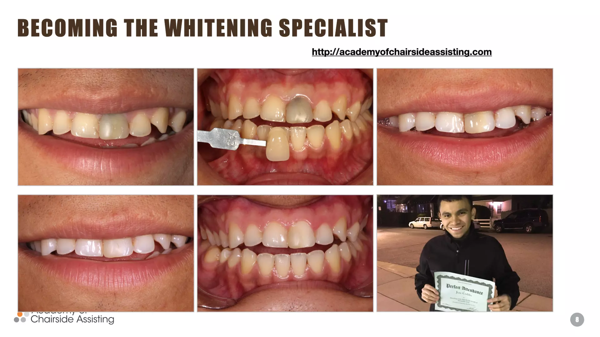 Up to 50% Off on Teeth Whitening at The Whitening Shop - Second Medium