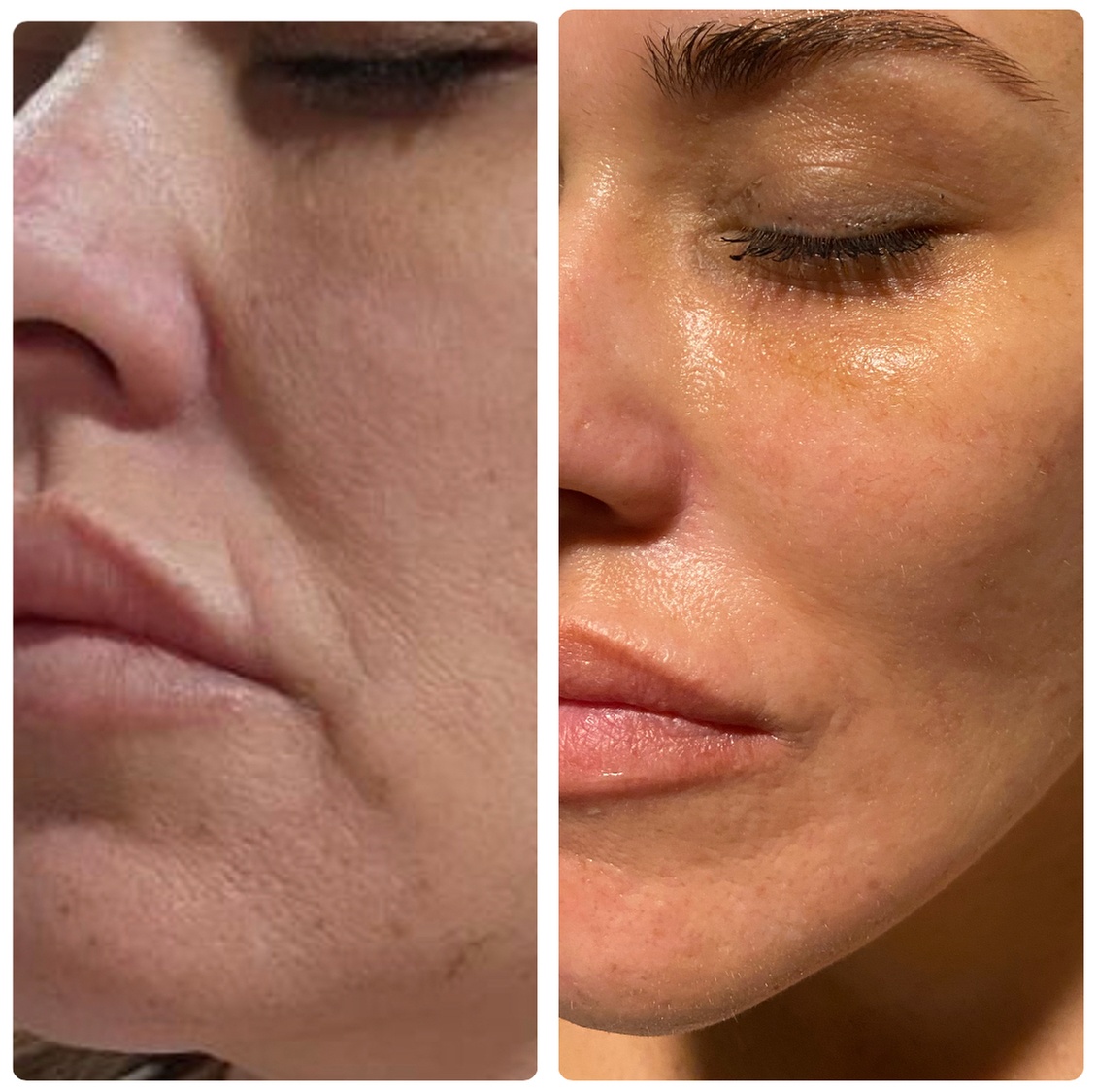 Up to 50% Off on Facial - Microcurrent at Holistic Health Sanctuary