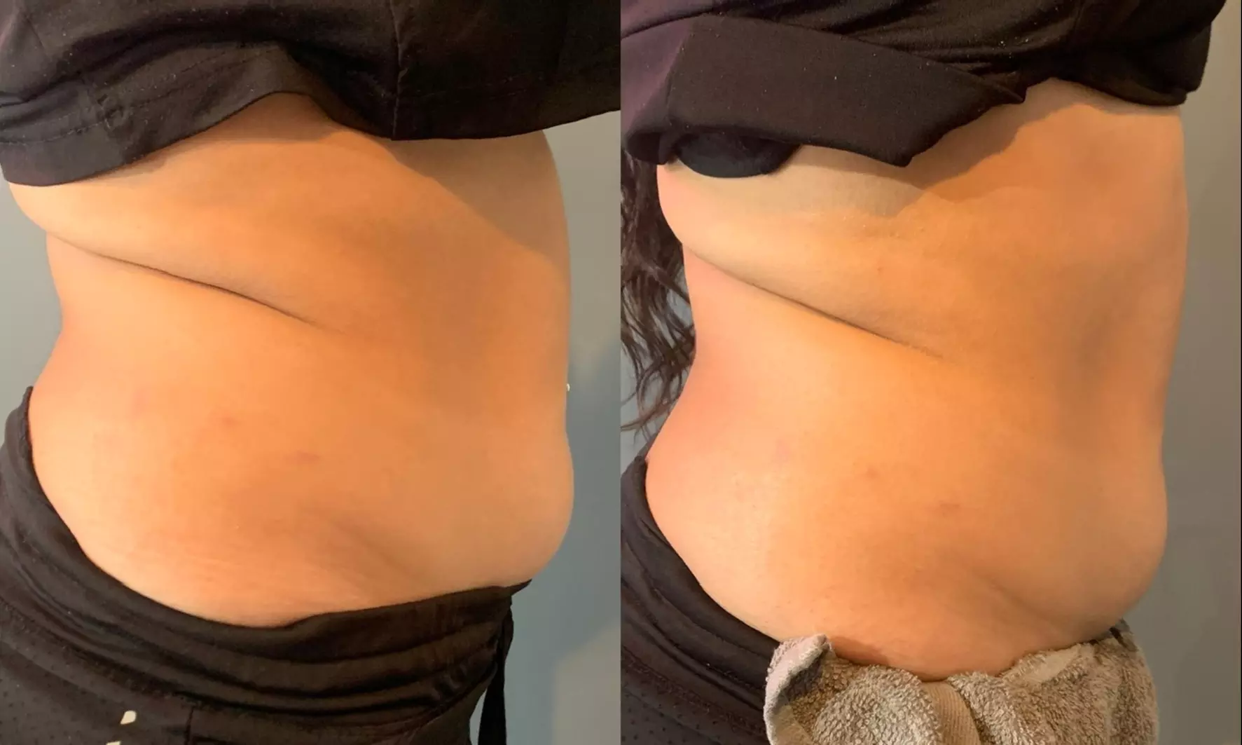 Up to 50% Off on Ultrasonic Fat Reduction at Make Me GorJess - Second Medium