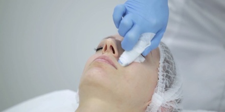 Microneedling with booster