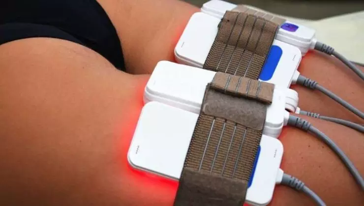 Non-Invasive Laser Lipo Treatments for a Slimmer You