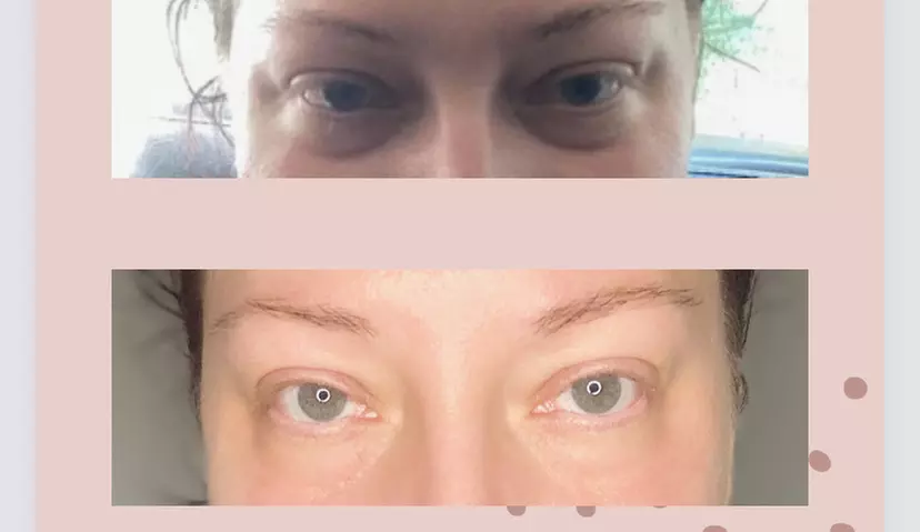 Up to 45% Off on Facelift - Non-Surgical at DeepHaven Rejuvenation - Primary Image