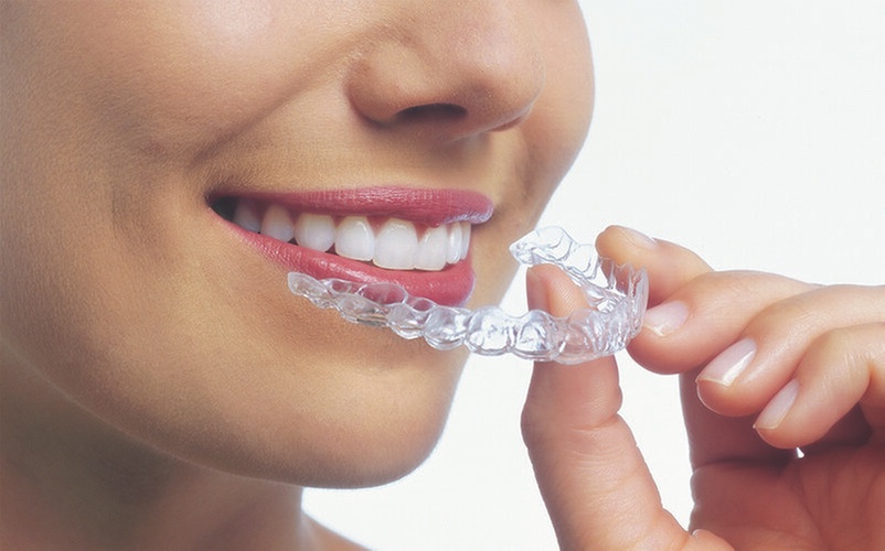 Experience Tomblyn Family Orthodontics with up to 50% off on Invisalign or Braces Treatment Packages - Primary Image