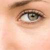 Image 1: Up to 45% Off Eyelid Surgery at Burien Medical Eye Care