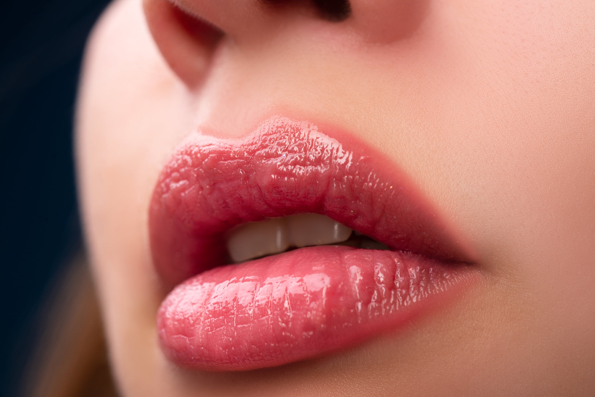 Up to 60% Off Russian Lip Filler at NYC MedSpa