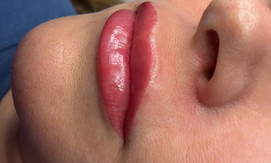 Image 3: Transform Your Look with a Lip Blushing/Neutralization Session