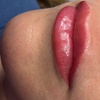 Image 3: Transform Your Look with a Lip Blushing/Neutralization Session
