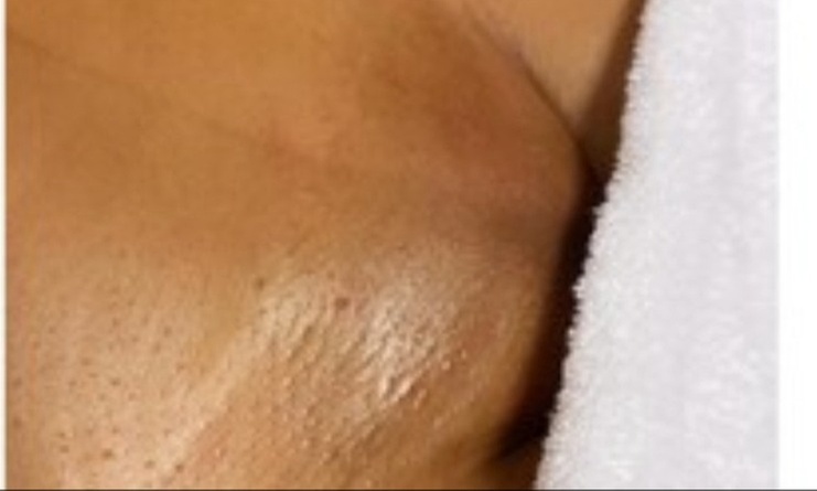 Smooth and Hair-Free with Brazilian Waxing Options