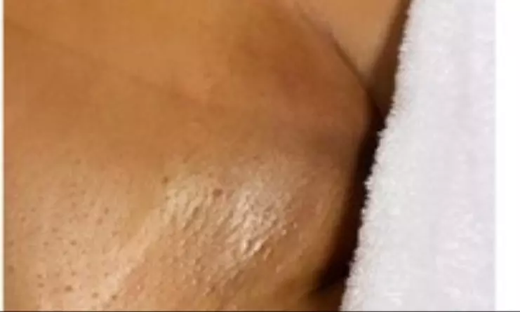 Gifted Hands Esthetics offers smoothness with Brazilian waxing and sugaring, up to 20% off. - Primary Image