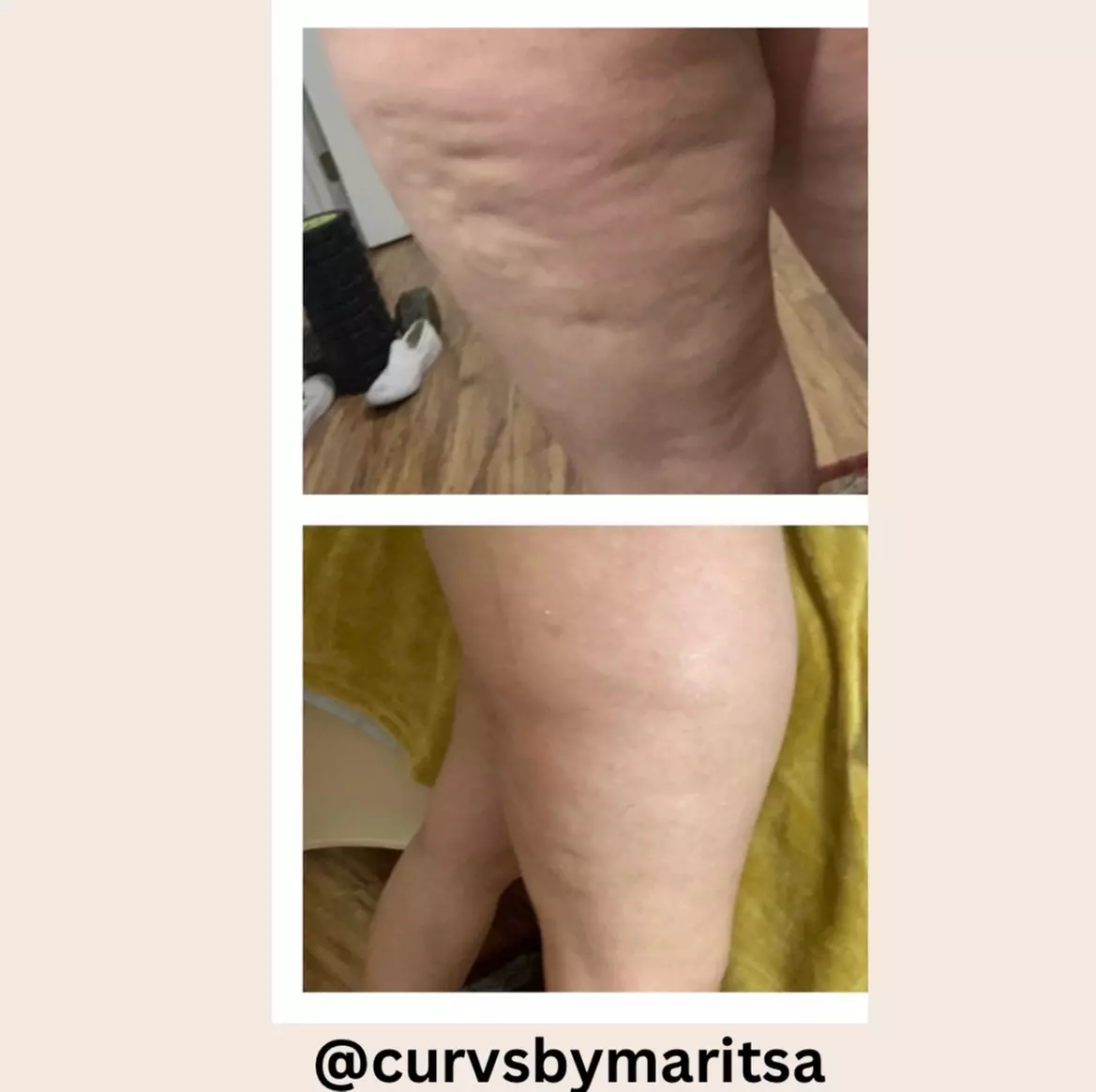 Up to 50% Off on Ultrasonic Fat Reduction at Curves and Aesthetics by Maritsa