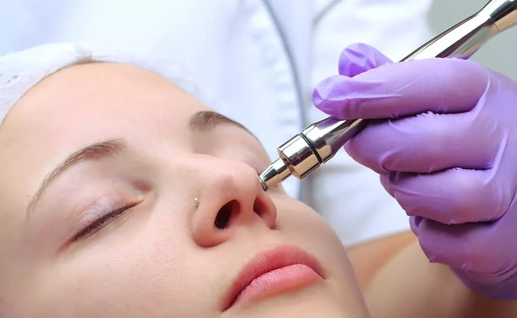 Up to 26% Off on Microdermabrasion at Cari Alyssa Esthetician - Primary Image
