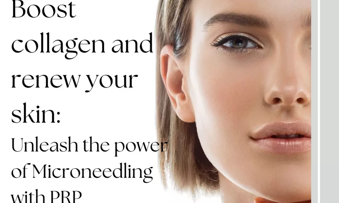 Up to 50% Off on Micro-Needling at Fountain of Youth SWFL - Primary Image