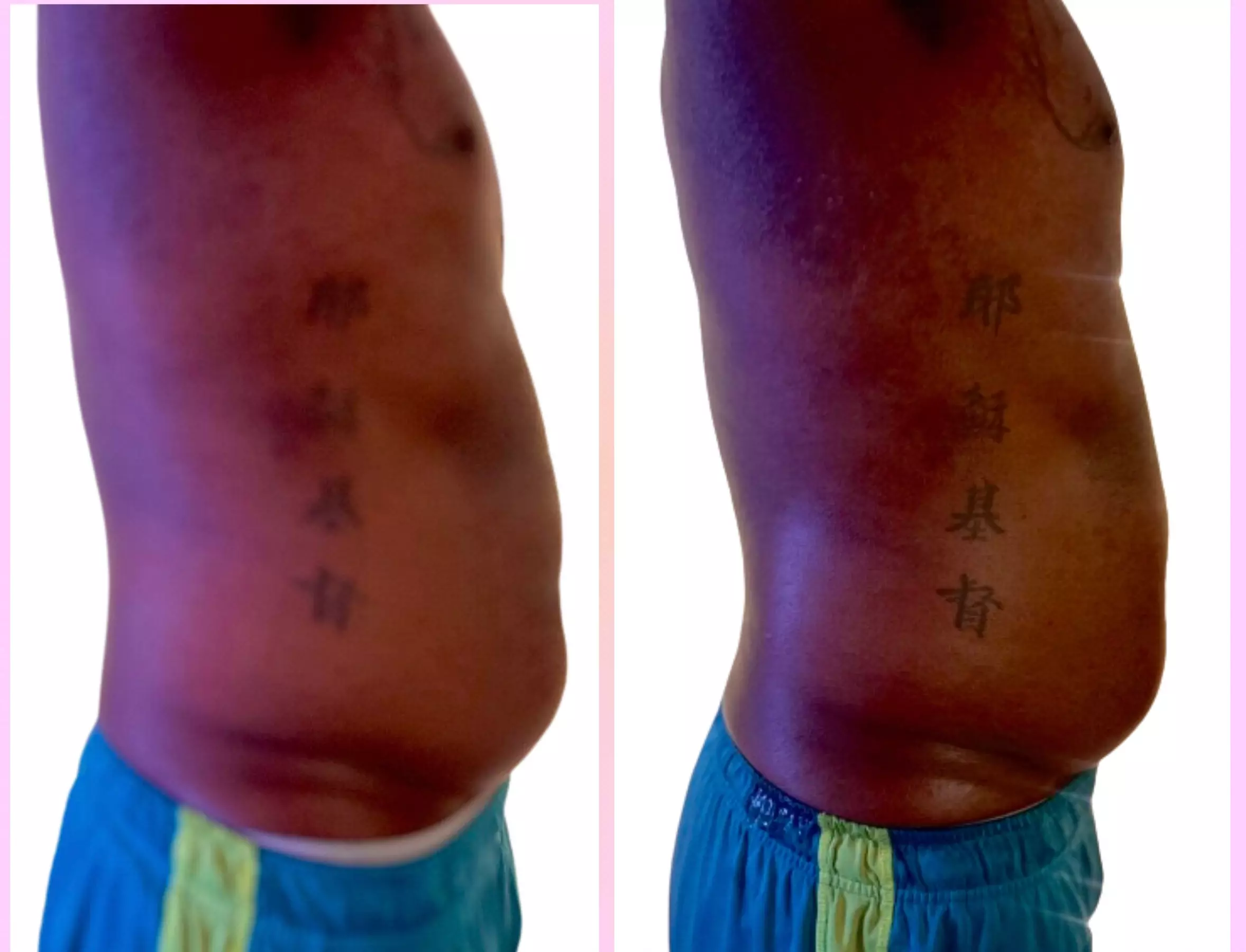 Experience Sa Renity Essentials' Ultrasonic Fat Reduction with up to 50% off, featuring various sculpting options. - Second Medium