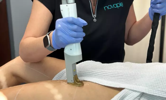 Up to 65% Off on Laser Hair Removal at NovaPiel Med Spa