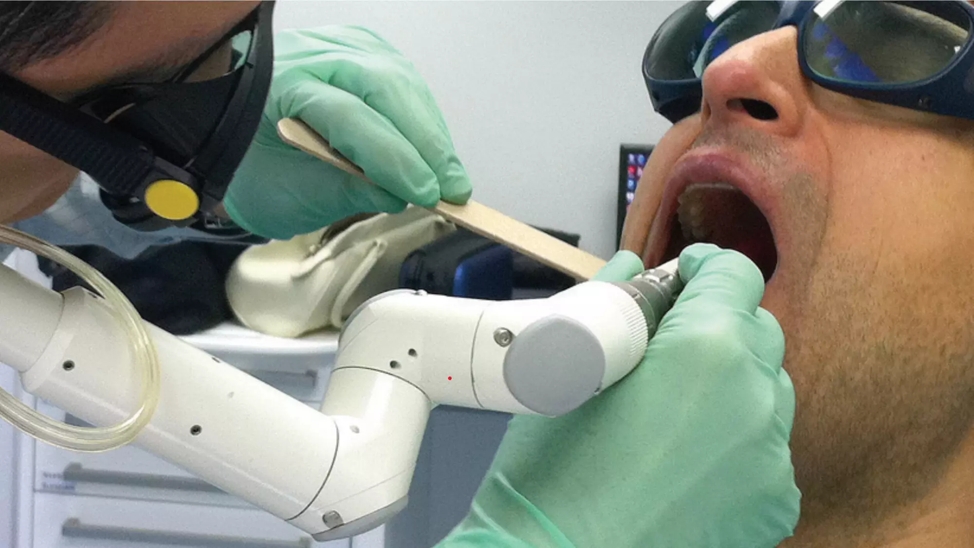 Up to 50% Off on One Session of Sleep Apnea/Snoring Correction Laser at Nidraveda PA - Second Medium