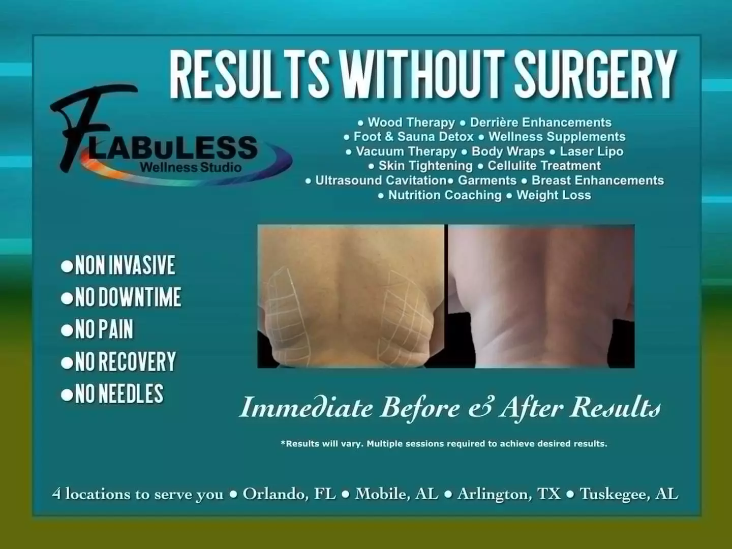 Up to 51% Off on Needle-Free Fat Dissolve Infusion at Flabuless Wellness Studio - Arlington - Primary Image