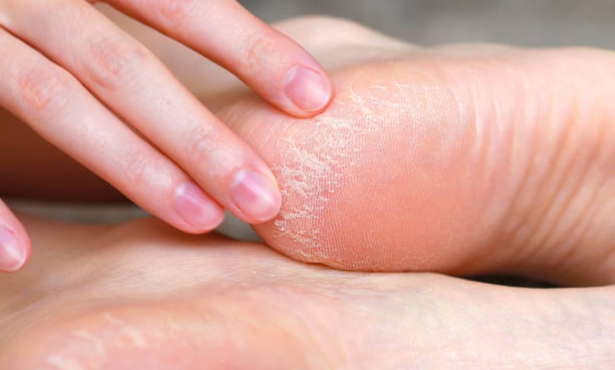 Image 1: Pause beauté et détente avec exfoliation des pieds et modelage dos
