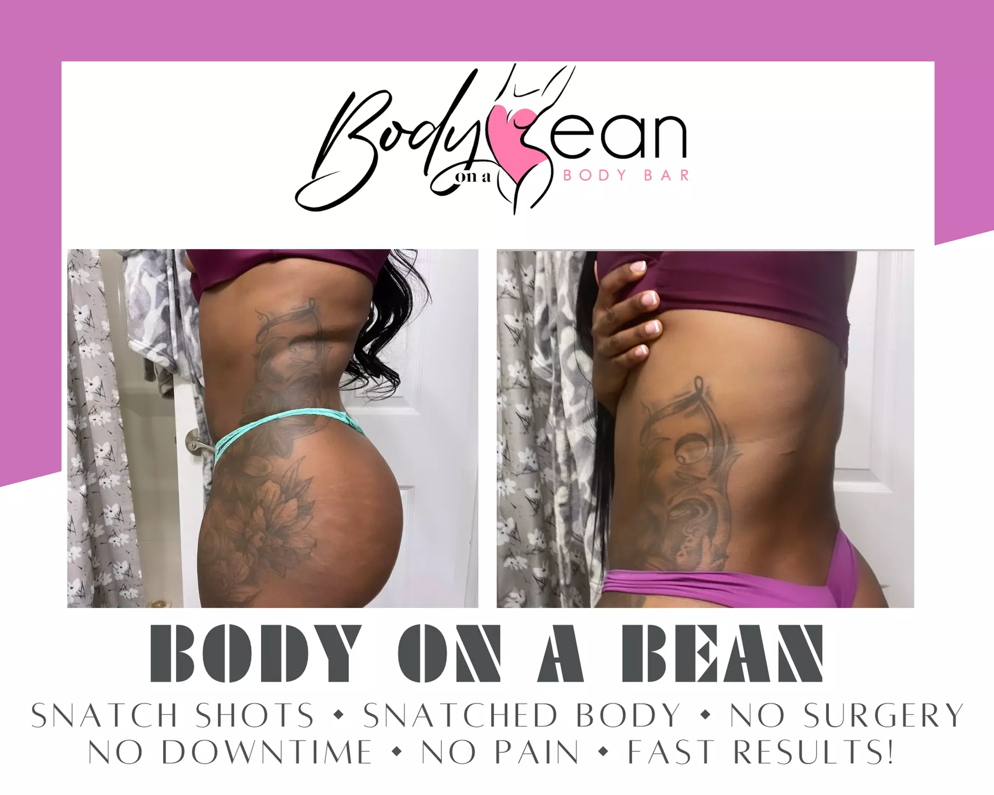 Up to 50% Off on Fat Reduction - Non-Branded at Body on a Bean - Primary Image