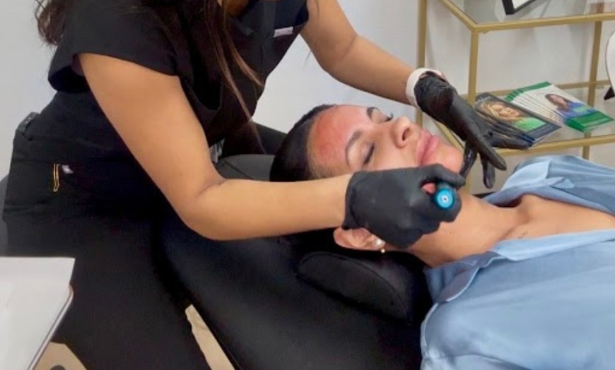 Image 2: Up to 60% Off on Micro-Needling at Valley Wellness and Aesthetics