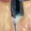 Image 1: Post-Op Lymphatic Massage at Post op curves(Up to 60% Off)