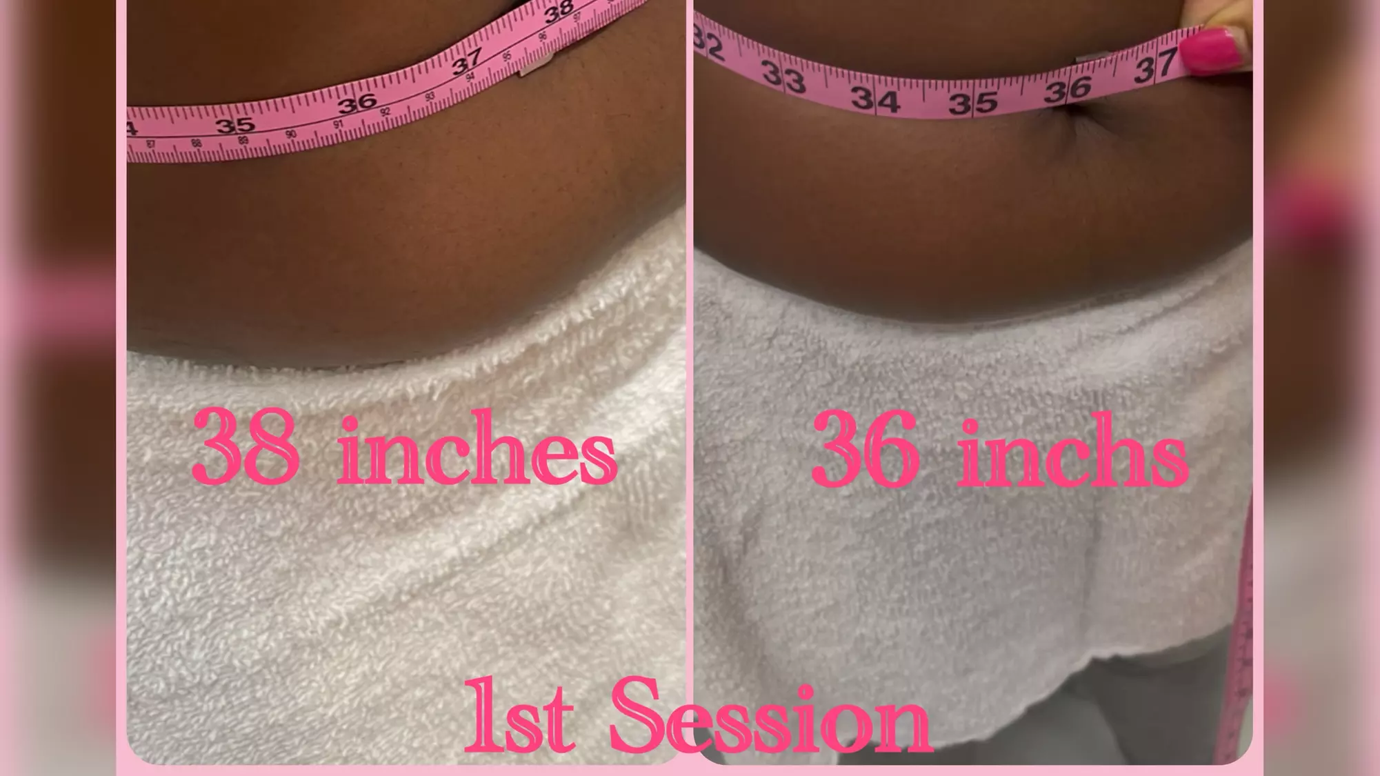 Shape & Tone Your Body with Cavitation and Vacuum Therapy Sessions