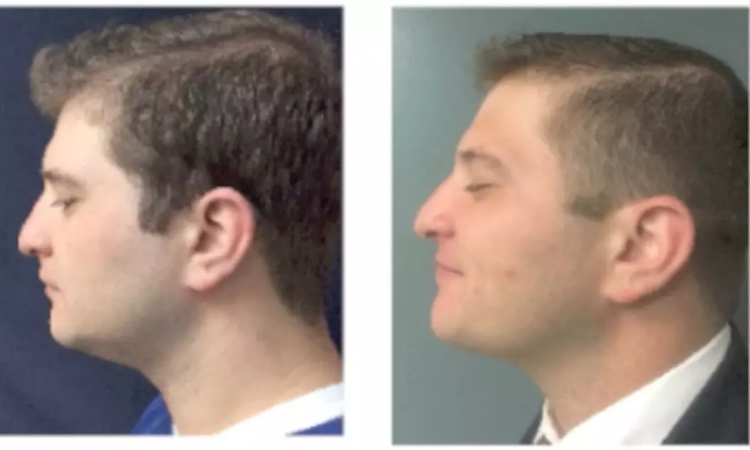 Up to 50% Off on Lipo - Non-Invasive Laser-iLipo at NJ Vein Care and Aesthetics Center - Primary Image