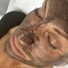 Image 2: Pico Laser Carbon Peel with Complimentary Facial Cleaning
