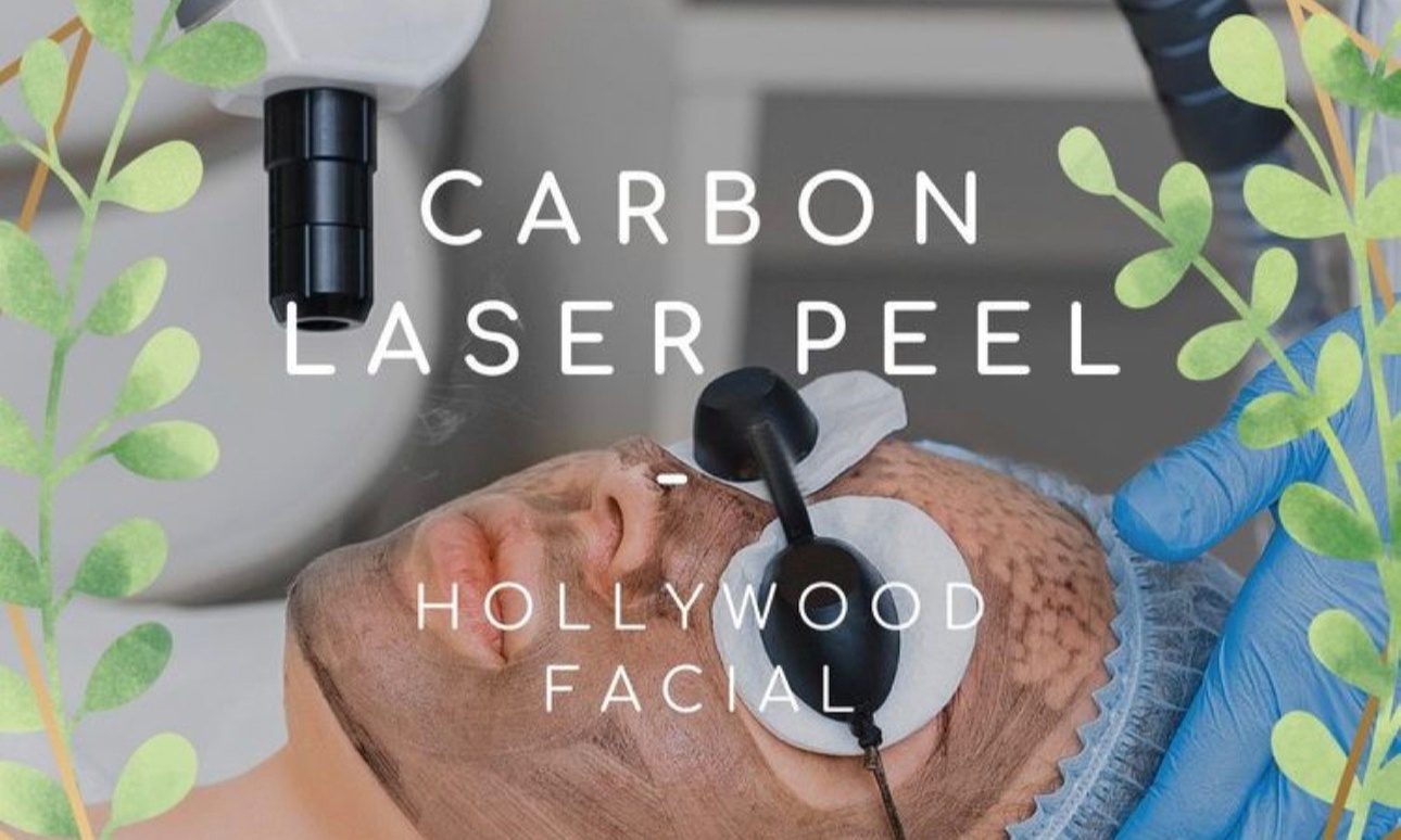 Up to 66% Off on Laser Skin Resurfacing at Ayat Beauty Salon