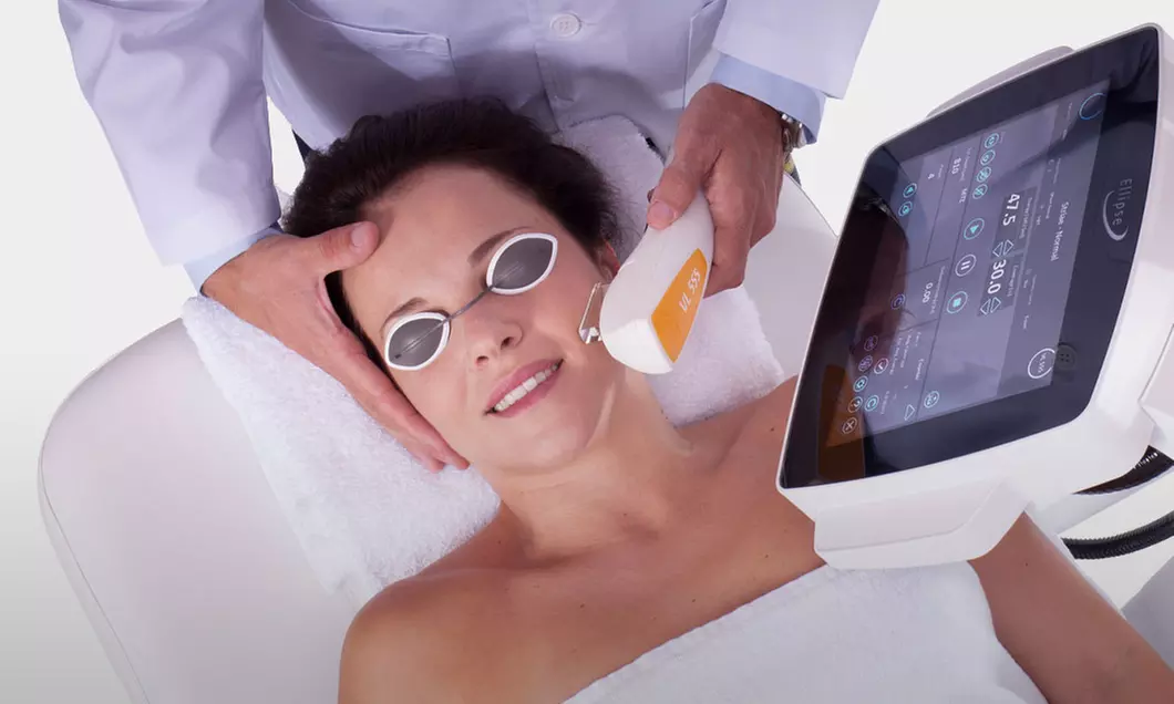 Up to 68% Off on IPL Photo Facial at Nuve Clinics - Primary Image