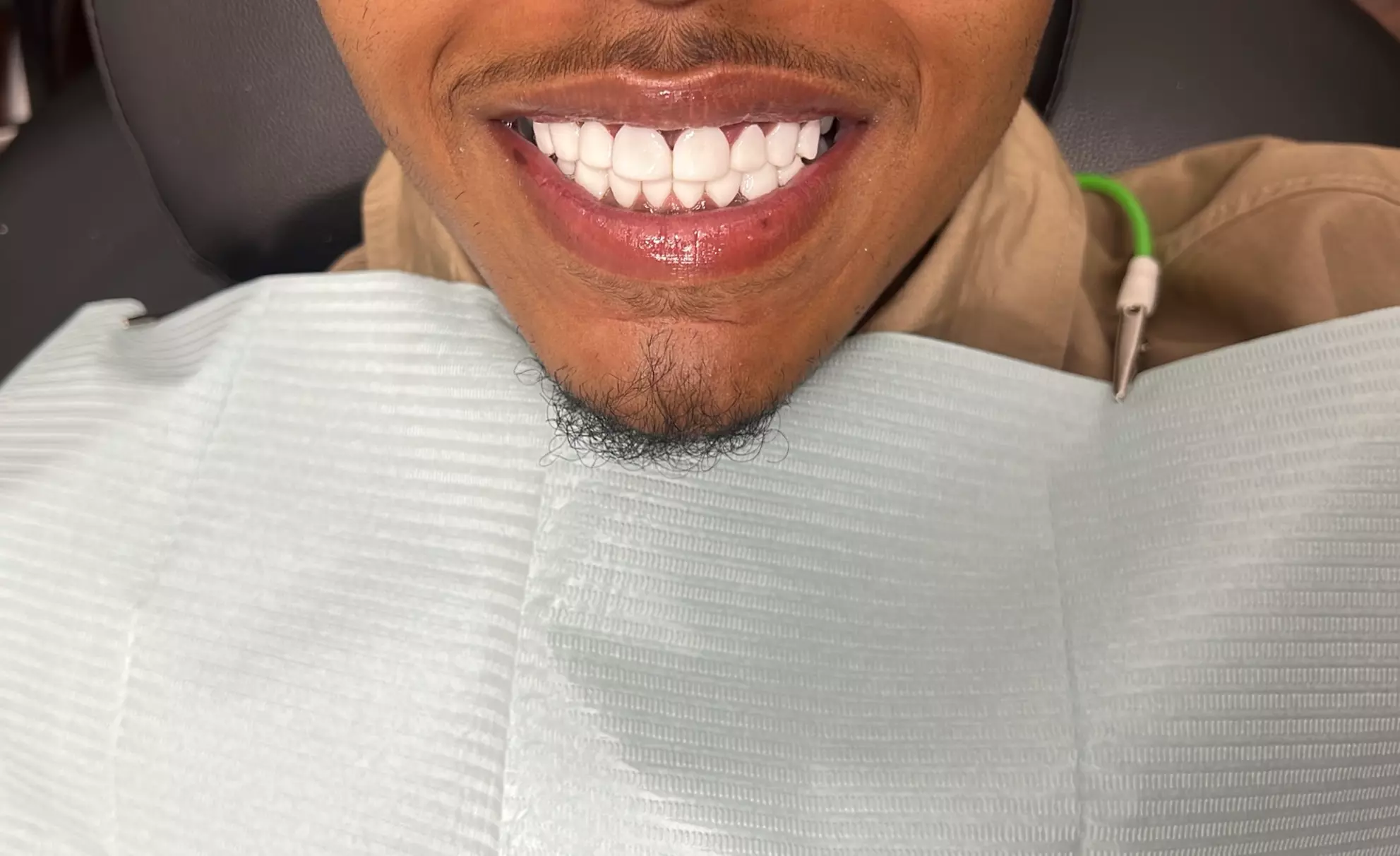 Up to 10% Off on Dental Implant / Corona / Veneer at New Smile Cosmetics LLC - Primary Image