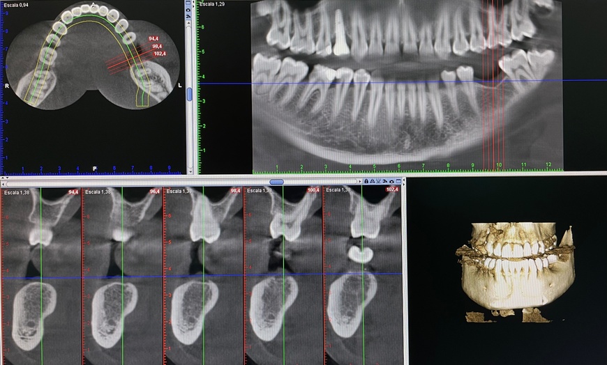 Image 3: Hasta 83% de descuento en Limpieza dental 