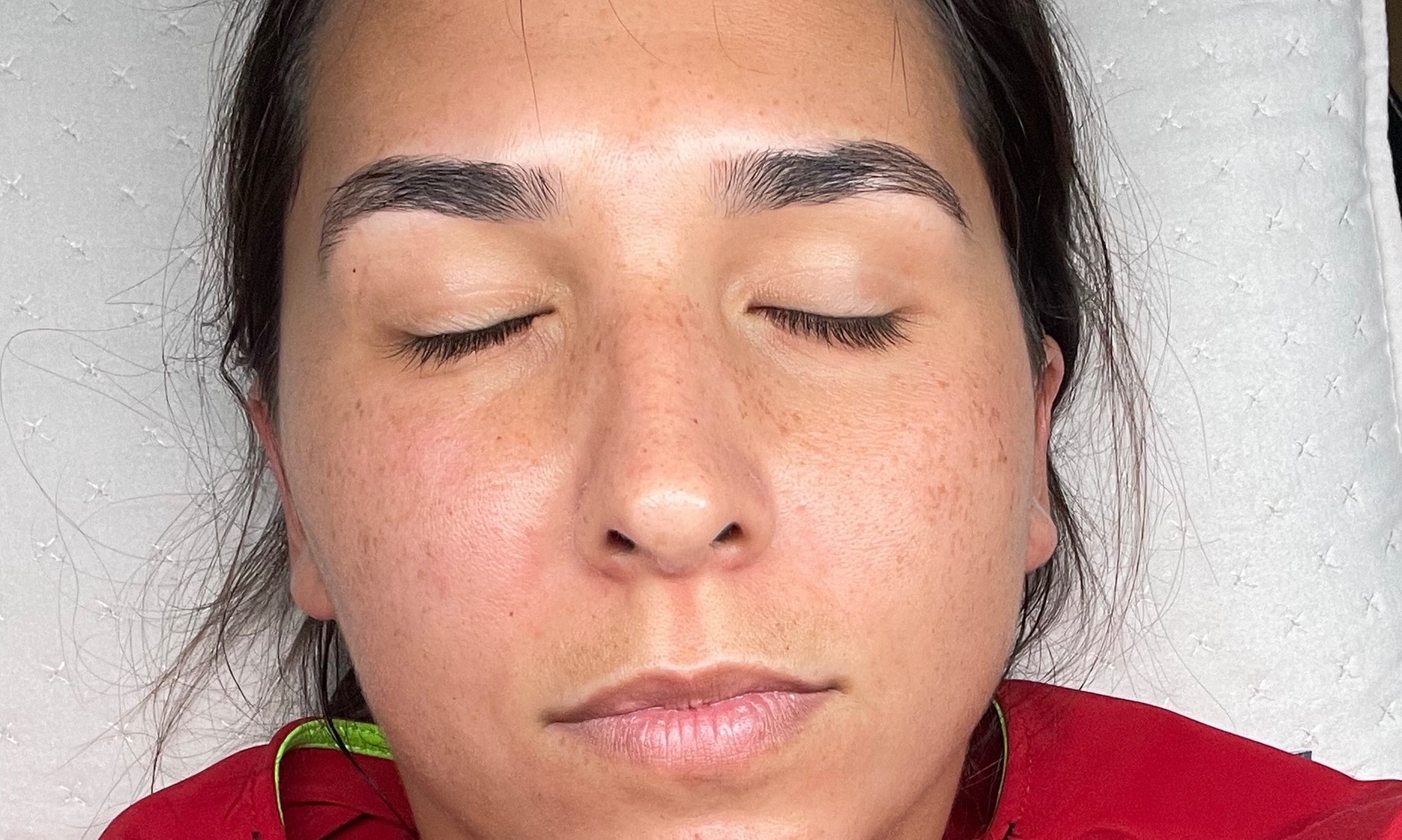 Up to 56% Off on Acne Treatment at Prestige Skin Care