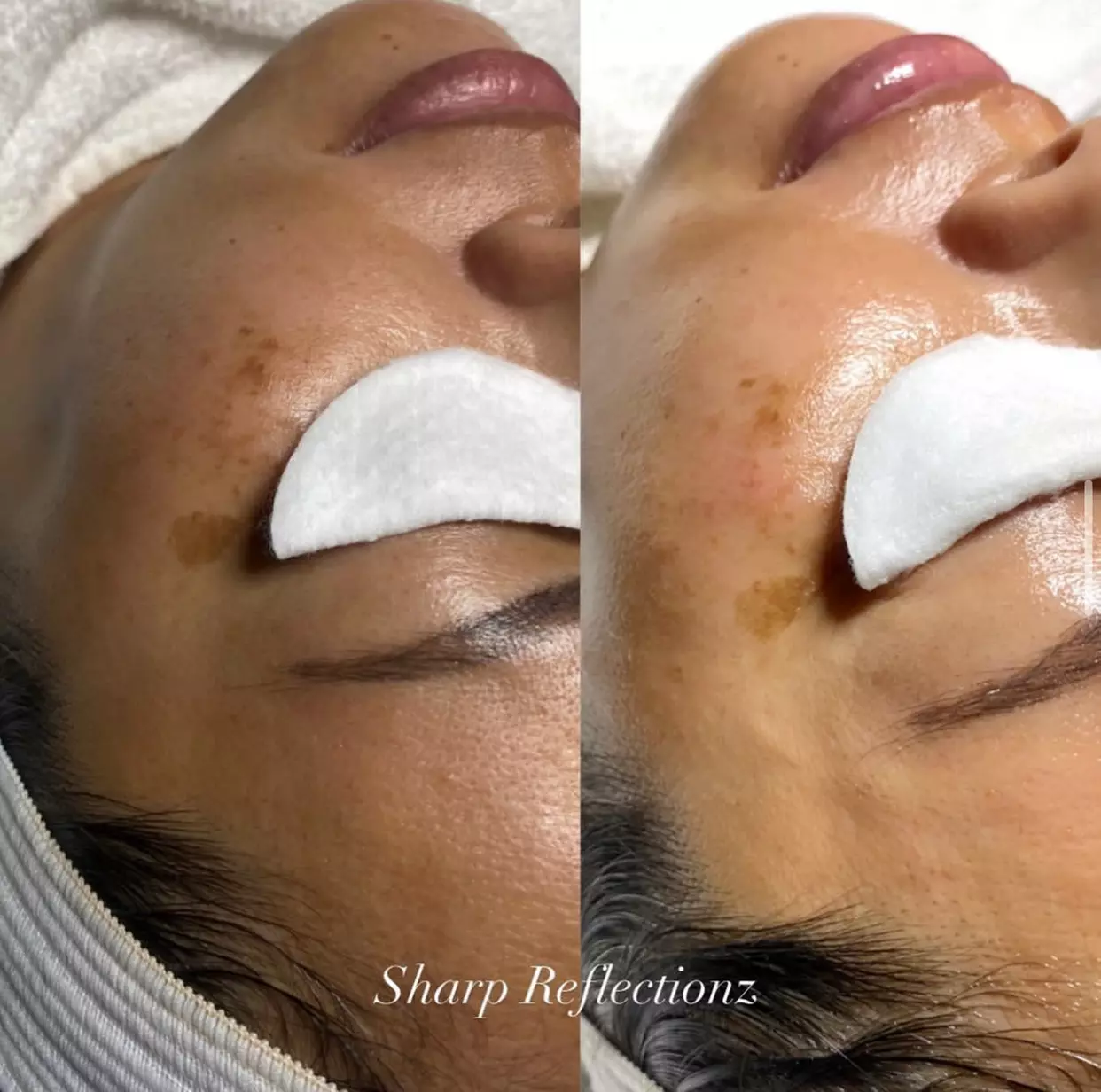 Brighten & Glow: Dermaplane + Hydration or 90-Minute Anti-Aging Treatment with 10-Minute Massage. Save Up to 45% - Second Medium