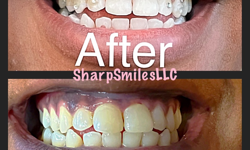 Image 2: Brighten Your Smile With Teeth Whitening, Polishing & More 