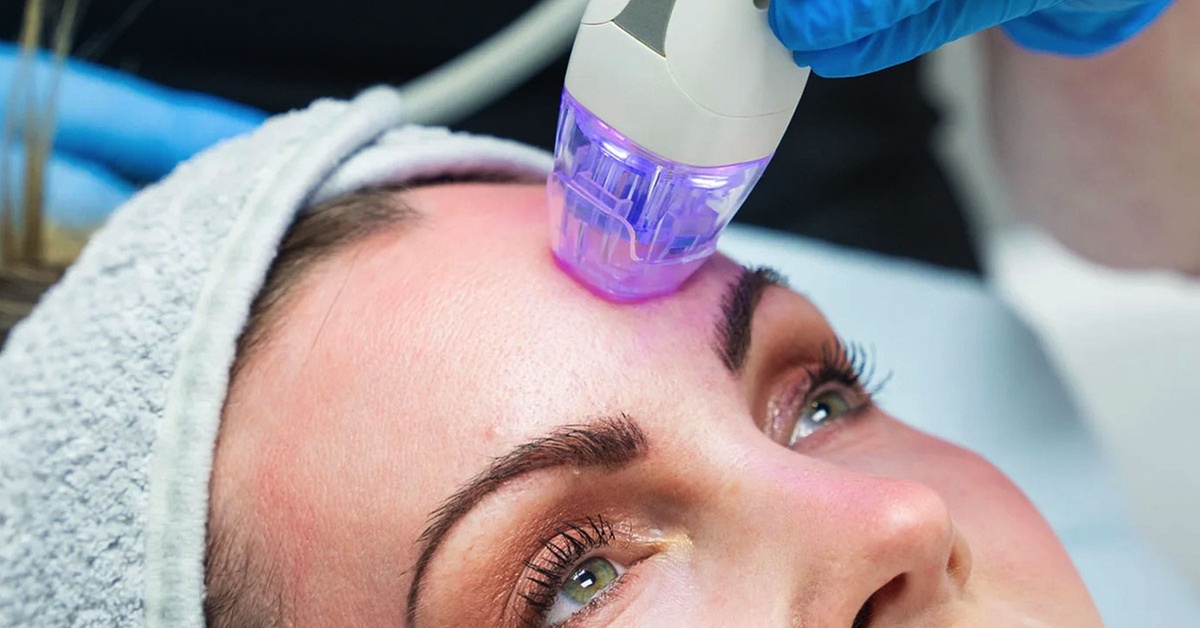 Enhance Your Look w/ Radio Frequency Microneedling for Neck | Face or Abs | Knees at Loma Laser (Up to 73% Off)