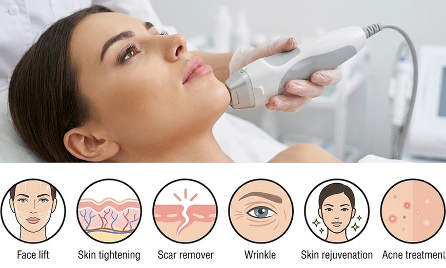 Image 3: Crystallite 8 RF Microneedling Treatment (Morpheus8 Alternative)