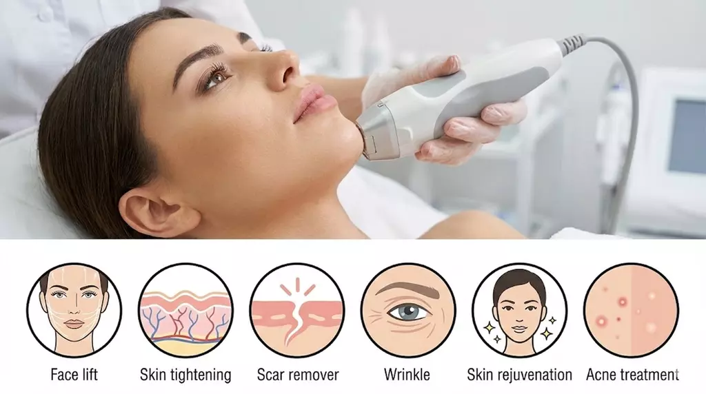 Crystallite 8 RF Microneedling Treatment (Advanced Morpheus8 Alternative) ( Up to 49% Off)