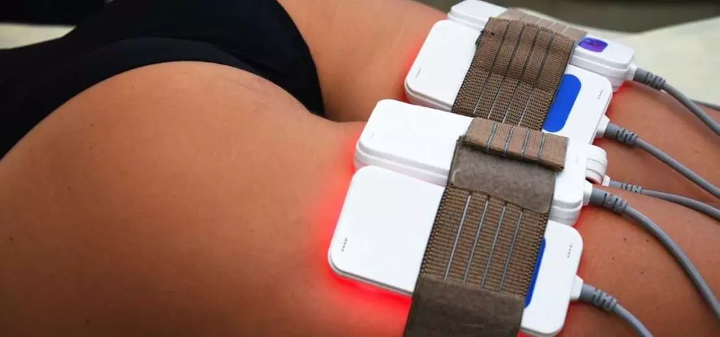 Up to 40% Off on Lipo - Non-Invasive Laser-iLipo at Beach City Body Contouring - Primary Image